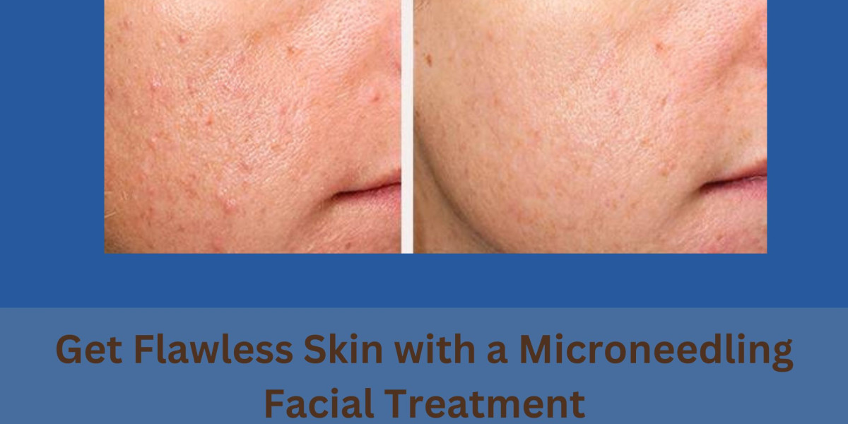 Get Flawless Skin with a Microneedling Facial Treatment